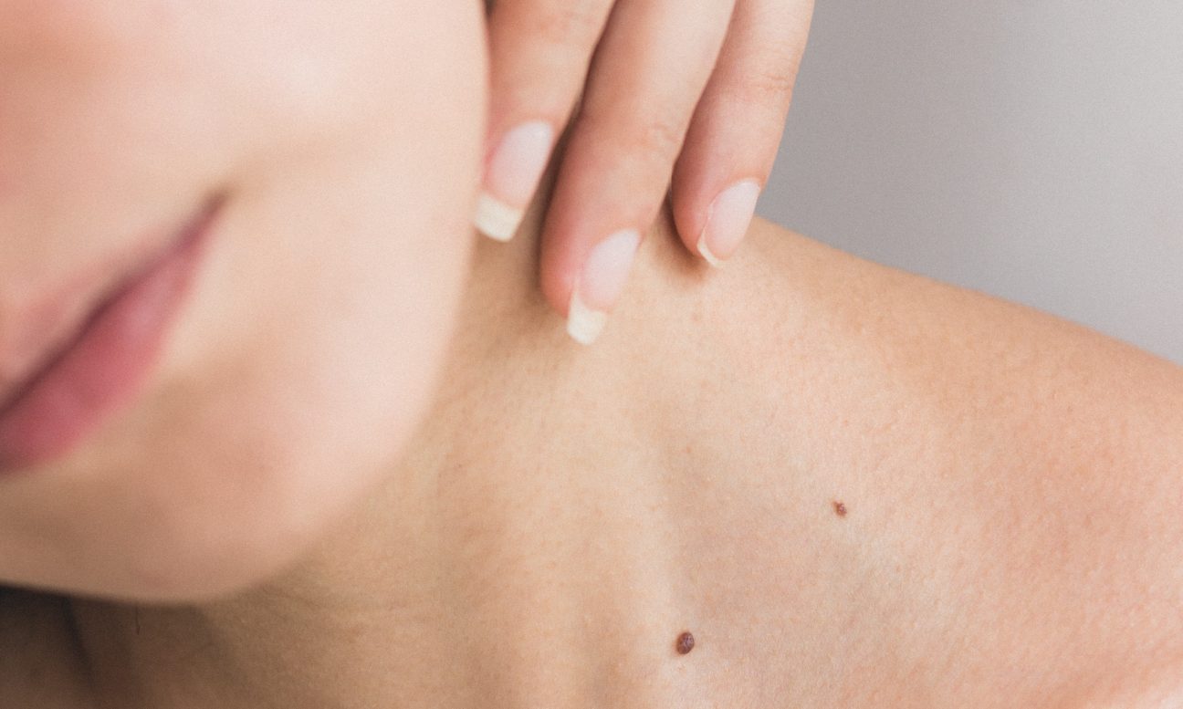 Cómo mantener la piel sana: Consejos de dermatología para una piel radiante